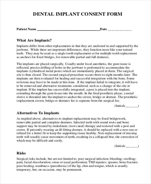 dental implant consent form sample