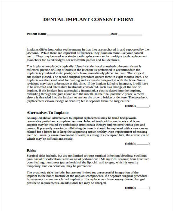 dental implant consent form