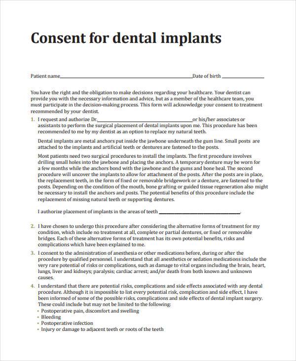 dental implants consent form