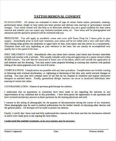 tattoo removal consent form