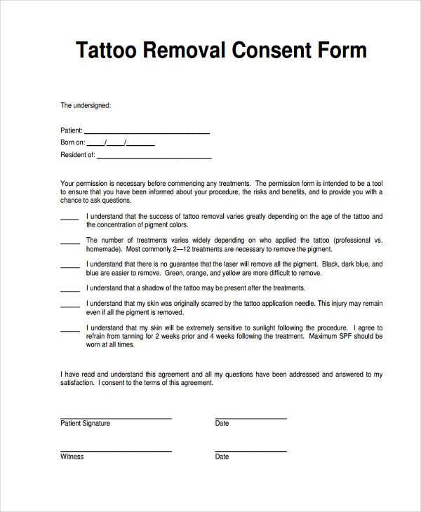 tattoo removal consent form
